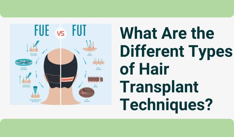 What Are the Different Types of Hair Transplant Techniques?