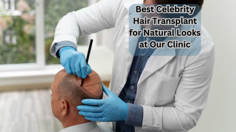 Best Celebrity Hair Transplant for Natural Looks at Our Clinic