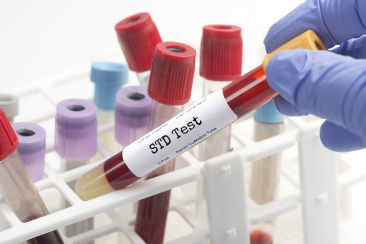 Same-Day STD Testing in NYC: What You Need to Know